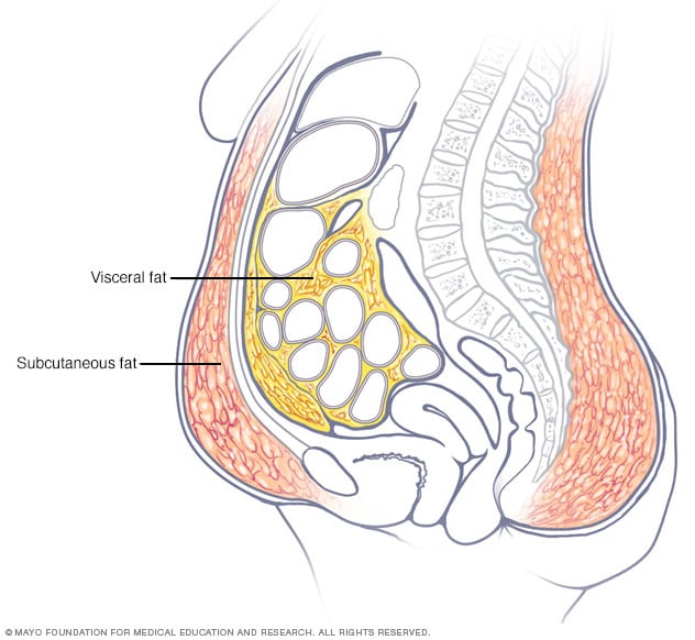 رسم توضيحي يظهر أماكن تراكم الدهون في البطن