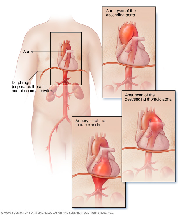 can eds cause upper chest discomfort