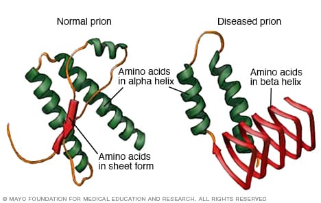 Illustrations comparing a normal prion with a diseased prion
