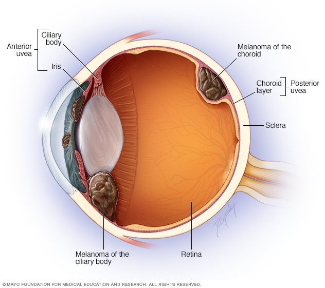 Retinal diseases - Symptoms and causes - Mayo Clinic