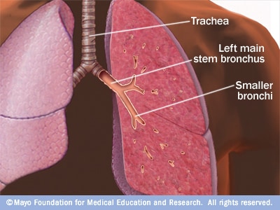 Illustration showing trachea and bronchi 
