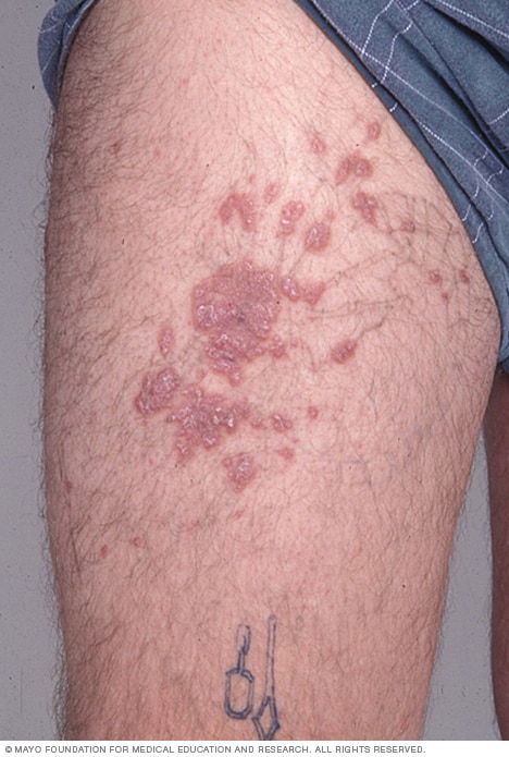 920+ Free Download Tattoo Healing Tips Idea Tattoo 920+ Free Download Tattoo Healing Tips Idea Tattoo