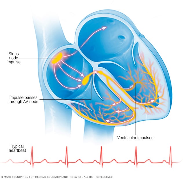 Ilustración que muestra latidos cardíacos normales
