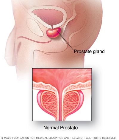 Standard a prostatitis alatt
