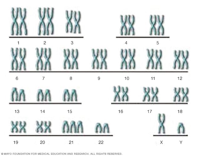 Risk Of Down Syndrome By Age Chart