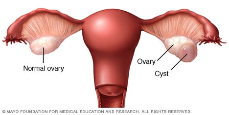 how big is an ovary