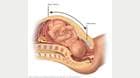 Measurement of fundal height during pregnancy