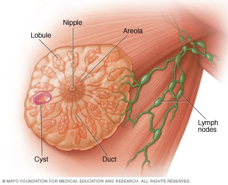 caffeine cyst breast