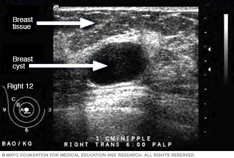 Ultrasound  Mayo Clinic