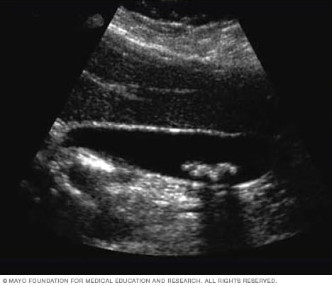 what is presentation in ultrasound