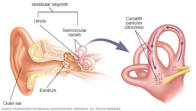 The inner ear and canalith repositioning