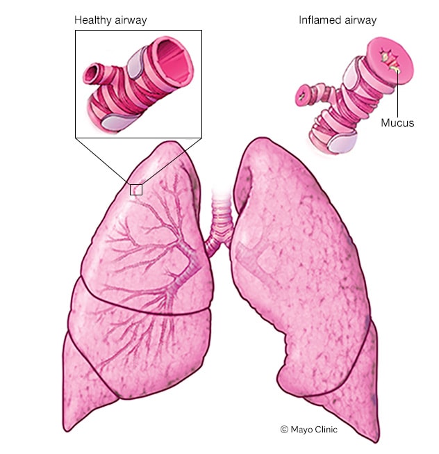 Diagnostic Flow Chart For Asthma In Clinical Practice