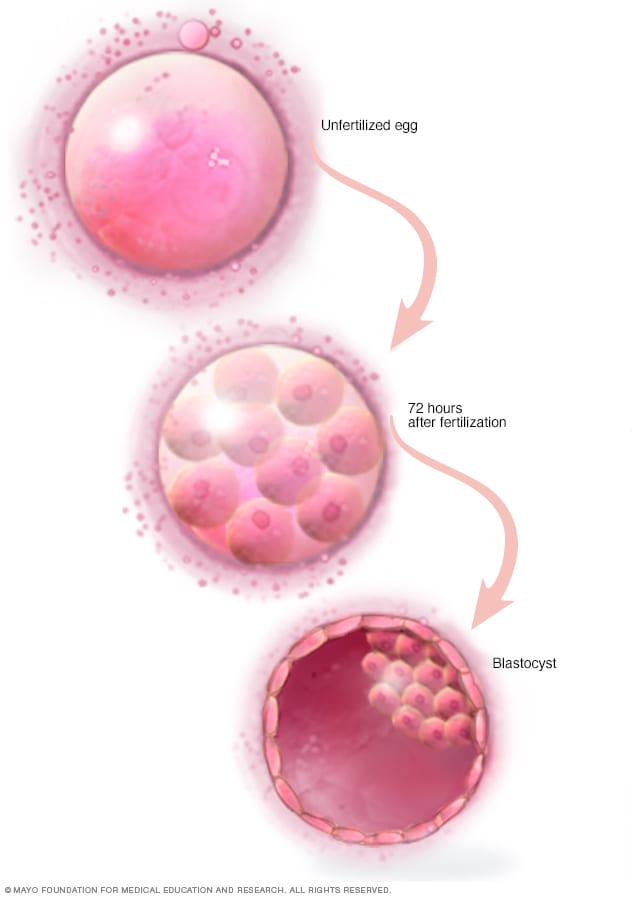 Blastocyst