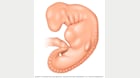 受孕 4 周后的胚胎 