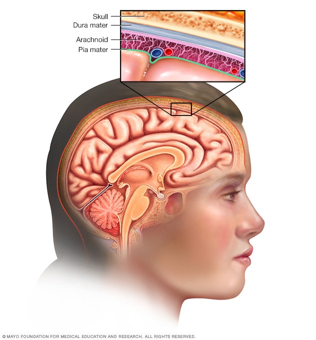 localização da meningite