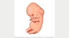 受孕 6 周后的胚胎 