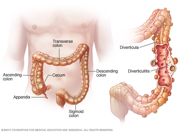 Pouches in digestive tract 