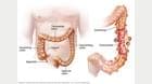 Pouches in digestive tract 
