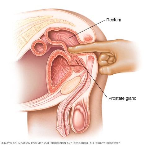 prostate exam process