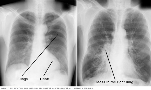 Imagen médica de radiografías de tórax