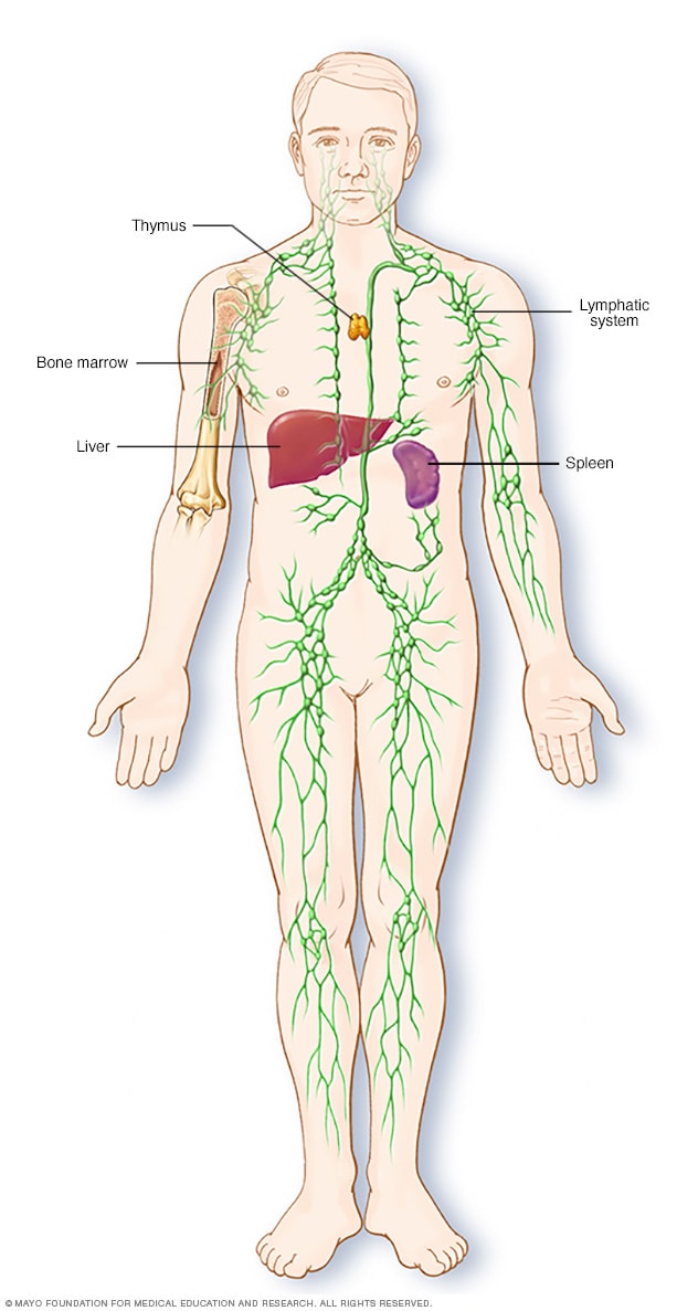 cancer limfatic hodgkin