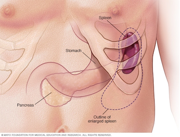 Causes of Spleen Pain