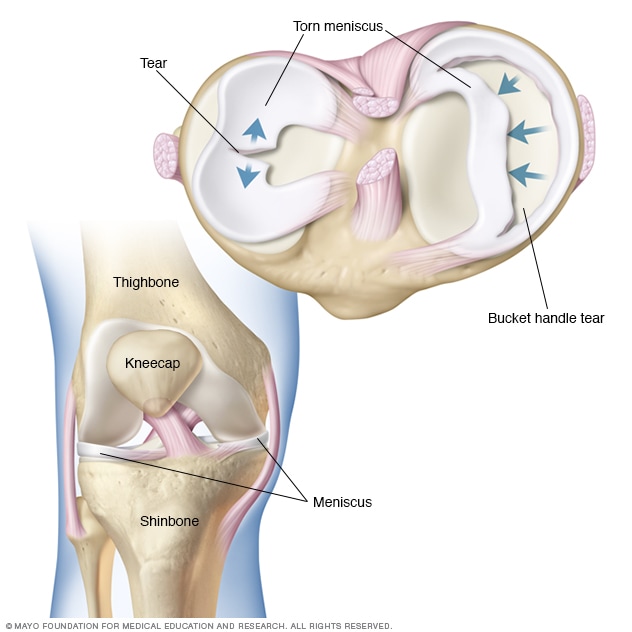 Knee Injury Chart