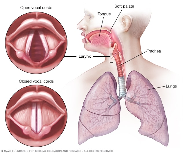 Resultado de imagen para laringitis causas