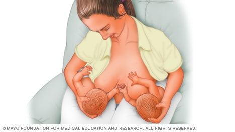 Woman breastfeeding twins with football hold
