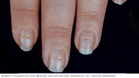 Nail Diseases And Disorders Chart