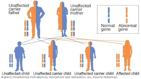 常染色体隐性遗传模式