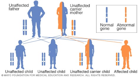 X-linked recessive inheritance with carrier mother