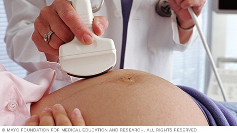 Mujer embarazada que se somete a una ecografía fetal
