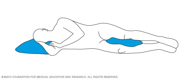 Sleeping positions that reduce back pain - Mayo Clinic