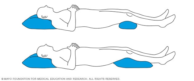 Sleeping positions that reduce back pain - Mayo Clinic