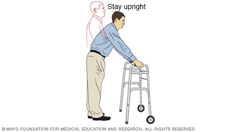 Ilustración de una persona usando un andador incorrectamente