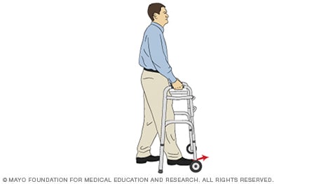 Illustration of a person moving forward with a walker