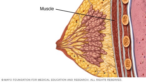 Mastitis - Symptoms and causes - Mayo Clinic