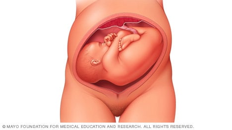 Baby six months position pregnant Sleeping Positions