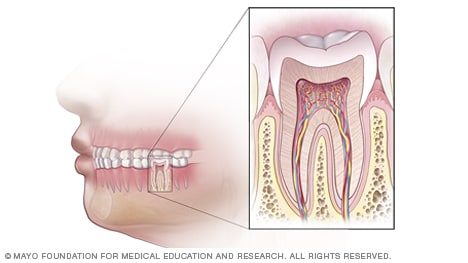 Ilustración de un diente sano
