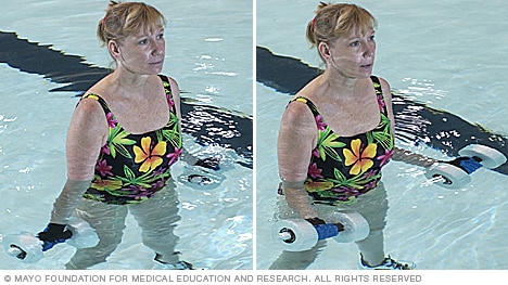 A person doing an arm exercise using water weights