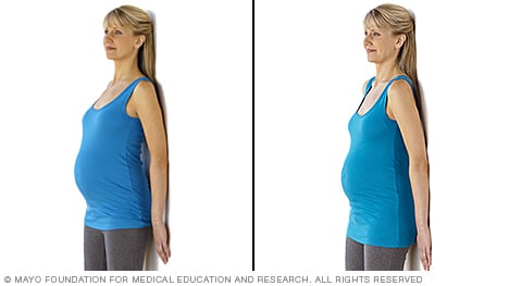 Persona embarazada realizando un ejercicio de inclinación pélvica de pie.