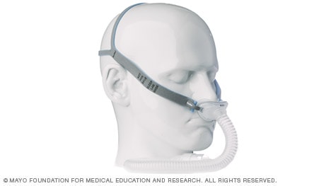 Fotografía de ejemplo de una máscara de CPAP