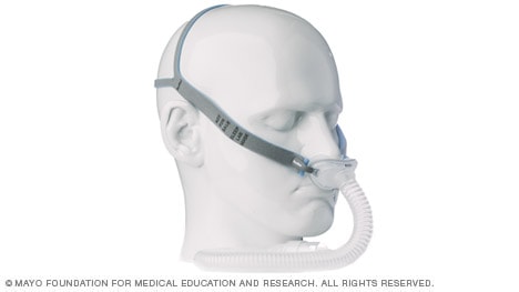 صورة لمثال على قناع الضغط الإيجابي المستمر في المسالك الهوائية (CPAP)