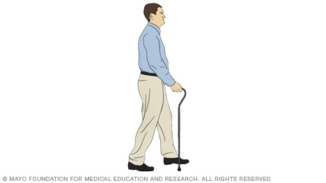 A person taking a step with a cane