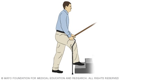 A person using stairs with a cane