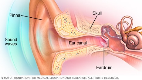 Middle Ear Infection Chart