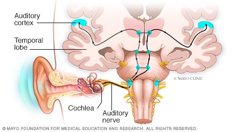 Cómo los impulsos eléctricos viajan al cerebro