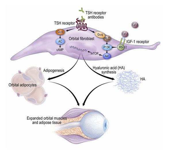 Graphic depicting the role of the thyrotropin (TSH) receptor in the immunopathogenesis of GO