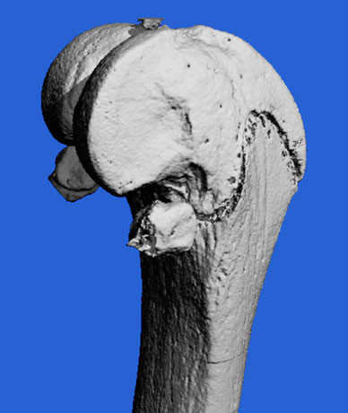 MicroCT scan image of mouse model bone